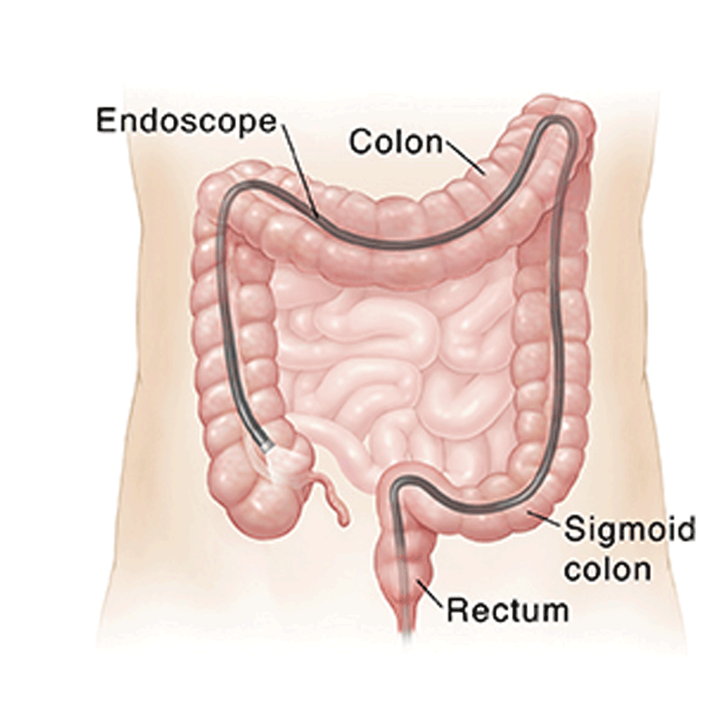 INTERVENTIONAL ENDOSCOPY PKLI&RC