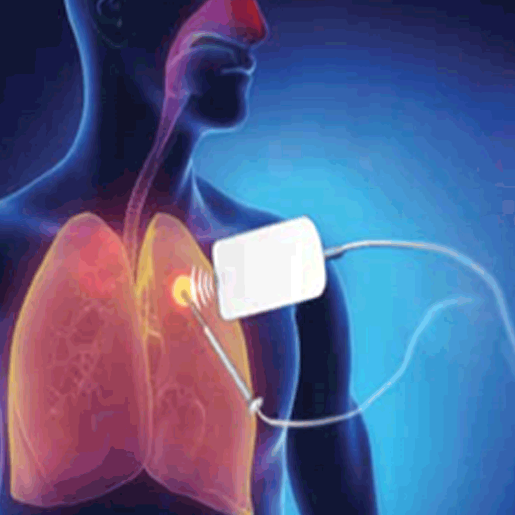 TUMOUR ABLATION PKLI&RC